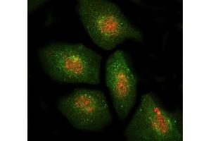 IF analysis of DBF4 using anti-DBF4 antibody (ABIN7601162) and anti-Beta Tubulin antibody (ABIN7602743). (DBF4 抗体  (AA 295-665))