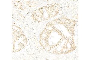 Immunohistochemistry (IHC) image for anti-RAD9 Homolog A (S. Pombe) (RAD9A) (C-Term) antibody (ABIN7454682) (RAD9A 抗体  (C-Term))