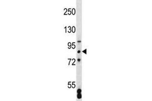 SATB2 antibody western blot analysis in MCF-7 lysate (SATB2 抗体  (AA 410-439))