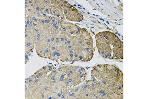 Immunohistochemistry of paraffin-embedded human stomach using THBS2 antibody. (Thrombospondin 2 抗体)