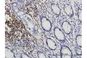 Image no. 2 for anti-C-Src tyrosine Kinase (CSK) (AA 1-101) antibody (ABIN598630) (CSK 抗体  (AA 1-101))