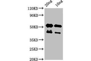 Western Blot Positive WB detected in Recombinant protein All lanes: lats2 antibody at 3 μg/mL Secondary Goat polyclonal to rabbit IgG at 1/50000 dilution Predicted band size: 43 kDa Observed band size: 43, 53 kDa (LATS2 抗体  (AA 1022-1140))