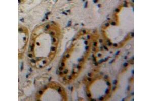 Immunohistochemistry (IHC) image for anti-Thrombospondin, Type I, Domain Containing 7A (THSD7A) (AA 42-242) antibody (ABIN7442552)