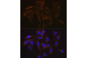 Immunofluorescence analysis of U-2 OS cells using V Rabbit mAb (ABIN7271312) at dilution of 1:100 (40x lens).