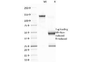 SDS-PAGE Analysis Purified EBV Mouse Monoclonal Antibody (CS1). (EBV LMP1 抗体)