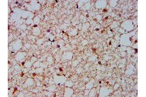 IHC image of ABIN7161538 diluted at 1:600 and staining in paraffin-embedded human brain tissue performed on a Leica BondTM system. (NFKBIL1 抗体  (AA 185-312))