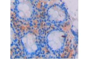 IHC-P analysis of Kidney tissue, with DAB staining. (GREM2 抗体  (AA 22-168))