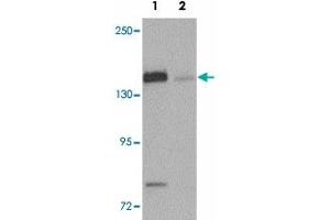 Western blot analysis of N4BP1 in HeLa cell lysate with N4BP1 polyclonal antibody  at 0.