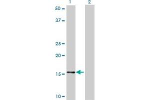 Western Blotting (WB) image for anti-NADH Dehydrogenase (Ubiquinone) 1 beta Subcomplex, 7, 18kDa (NDUFB7) (AA 38-137) antibody (ABIN518242)