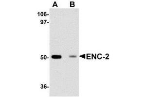 Western blot analysis of ENC-2 in Jurkat cell lysate with AP30315PU-N ENC-2 antibody at 1 μg/ml in (A) the absence and (B) the presence of blocking peptide. (KLHL25 抗体  (Center))