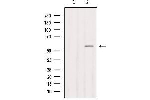 Western blot analysis of extracts from COS-7, using Cytochrome P450 2B6 Antibody. (CYP2B6 抗体)