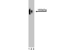 Western blot analysis of delta-Catenin on a rat cerebrum lysate. (CTNND2 抗体  (AA 85-194))