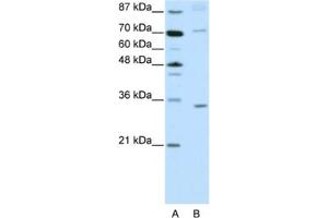 Western Blotting (WB) image for anti-Atonal Homolog 8 (ATOH8) antibody (ABIN2461959) (ATOH8 抗体)