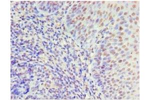 Immunohistochemistry of paraffin-embedded human tonsil tissue using ABIN7150338 at dilution of 1:100 (MCM5 抗体  (AA 1-230))