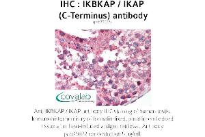 Image no. 1 for anti-Elongator Complex Protein 1 (ELP1) antibody (ABIN1735852) (IKAP/p150 抗体)