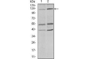 Western blot analysis using PIWIL4 mouse mAb against PC-3 (1) and PANC-1 (2) cell lysate. (PIWIL4 抗体  (AA 304-434))