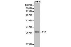 Western Blotting (WB) image for anti-Coagulation Factor XII (F12) antibody (ABIN1872625) (F12 抗体)
