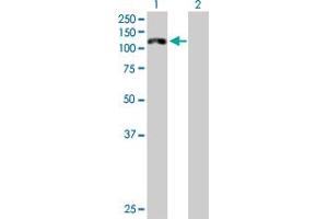 Western Blot analysis of CDH16 expression in transfected 293T cell line by CDH16 MaxPab polyclonal antibody. (Cadherin-16 抗体  (AA 1-829))