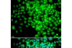 Immunofluorescence analysis of HeLa cells using POLR2F Polyclonal Antibody (POLR2F 抗体)