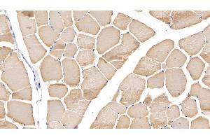 Immunohistochemistry (IHC) image for anti-Myosin Heavy Chain 2, Skeletal Muscle, Adult (MYH2) (AA 1237-1471) antibody (ABIN7440437)
