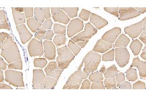 Detection of MYH2 in Human Skeletal muscle Tissue using Polyclonal Antibody to Myosin Heavy Chain 2 (MYH2) (MYH2 抗体  (AA 1237-1471))