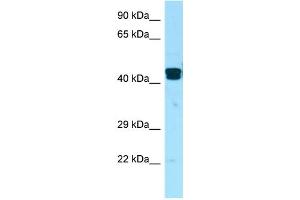 WB Suggested Anti-LIMS1 Antibody Titration: 1. (LIMS1 抗体  (Middle Region))