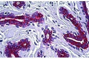 Human Breast: Formalin-Fixed, Paraffin-Embedded (FFPE) (Keratin 8/18/19 抗体)