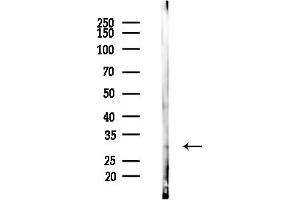 Western blot analysis of lysates from EC304 cells, using Phospho-Thymidine Kinase 1/TK1 (Ser13) Antibody at 1/1000 dilution.