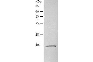 Western Blotting (WB) image for Tumor Necrosis Factor Receptor Superfamily, Member 13C (TNFRSF13C) (AA 1-76) protein (His tag) (ABIN7125550) (TNFRSF13C Protein (AA 1-76) (His tag))