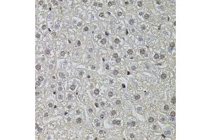 Immunohistochemistry (IHC) image for anti-Processing of Precursor 4, Ribonuclease P/MRP Subunit (POP4) (AA 1-220) antibody (ABIN6145964)