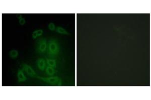 Immunofluorescence analysis of A549 cells, using FXR2 antibody. (FXR2 抗体  (C-Term))