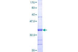 NR2F2 Protein (AA 153-240) (GST tag)