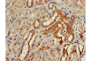 Immunohistochemistry of paraffin-embedded human kidney tissue using ABIN7147659 at dilution of 1:100 (GCM2 抗体  (AA 156-451))