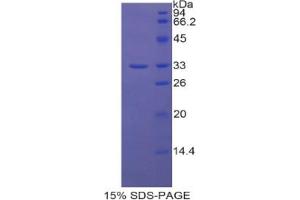 SDS-PAGE (SDS) image for Solute Carrier Family 17 (Acidic Sugar Transporter), Member 5 (SLC17A5) protein (ABIN2967663)