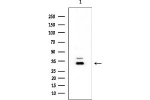 anti-Acidic (Leucine-Rich) Nuclear phosphoprotein 32 Family, Member E (ANP32E) antibody