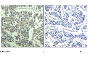 Image no. 1 for anti-Mast/stem Cell Growth Factor Receptor (KIT) (pTyr936) antibody (ABIN319288) (KIT 抗体  (pTyr936))