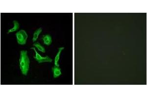 Immunofluorescence analysis of HeLa cells, using GPR133 Antibody. (G Protein-Coupled Receptor 133 抗体  (AA 461-510))