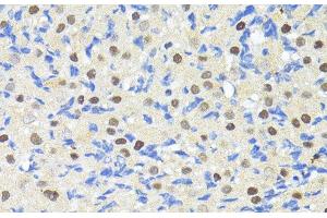 Immunohistochemistry of paraffin-embedded Rat ovary using TRIM27 Polyclonal Antibody at dilution of 1:100 (40x lens). (TRIM27 抗体)