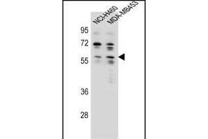 ANKRD34C Antibody (C-term) (ABIN655772 and ABIN2845210) western blot analysis in NCI-,MDA-M cell line lysates (35 μg/lane). (ANKRD34C 抗体  (C-Term))