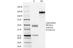 SDS-PAGE Analysis of Purified, BSA-Free Acidic Cytokeratin Antibody (clone AE1). (Keratin Acidic (AE1) 抗体)