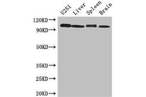 Western Blot Positive WB detected in: U251 whole cell lysate, Mouse liver tissue, Mouse Spleen tissue, Mouse brain tissue All lanes: MAP10 antibody at 3 μg/mL Secondary Goat polyclonal to rabbit IgG at 1/50000 dilution Predicted band size: 101 kDa Observed band size: 101 kDa (MAP1 抗体  (AA 401-600))