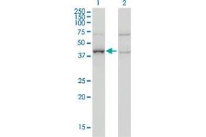 Western Blot analysis of ARMC8 expression in transfected 293T cell line by ARMC8 monoclonal antibody (M01), clone 2D9. (ARMC8 抗体  (AA 287-385))