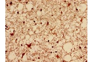 Immunohistochemistry analysis of human brain tissue using ABIN7150829 at dilution of 1:100 (Dynamin 1-Like 抗体  (AA 496-710))