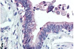 Lung, respiratory epithelium (CLIC4 抗体  (N-Term))
