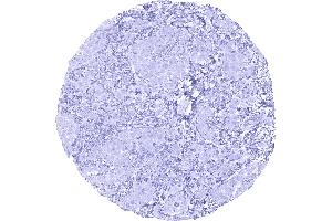 Immunohistochemistry (IHC) image for anti-Epithelial Cell Adhesion Molecule (EPCAM) (AA 100-224), (Extracellular Domain) antibody (ABIN7477469)