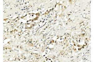 IHC analysis of PDCD4 using anti-PDCD4 antibody (ABIN5518943). (PDCD4 抗体  (AA 346-446))