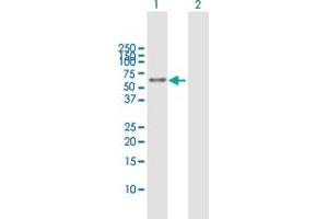 Western Blot analysis of ALDH3A2 expression in transfected 293T cell line by ALDH3A2 MaxPab polyclonal antibody. (ALDH3A2 抗体  (AA 1-508))
