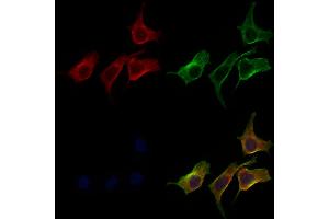 ABIN6265650 and ABIN6277686 staining 3 by IF/ICC.