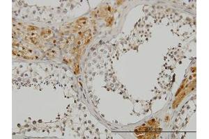Image no. 1 for anti-CAMP Responsive Element Binding Protein 3 (CREB3) (AA 273-372) antibody (ABIN599141) (CREB3 抗体  (AA 273-372))