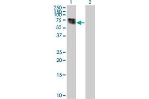 Western Blotting (WB) image for CTNS 293T Cell Transient Overexpression Lysate(Denatured) (ABIN1331485)